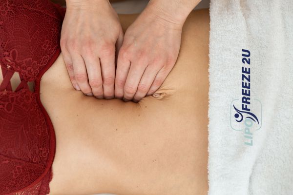diastasis recti treatment Southall