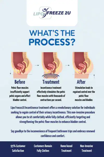 Diagram of how incontinence treatment Southall works.