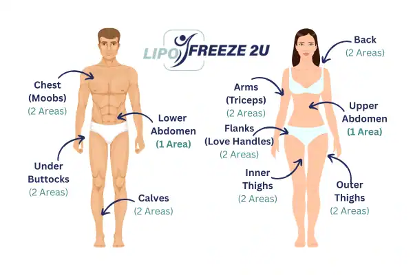 Areas you can have fat freezing treatment Southall
