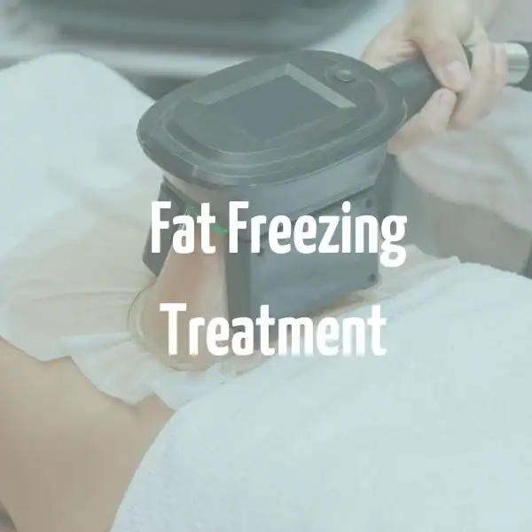 fat freezing treatment Southall