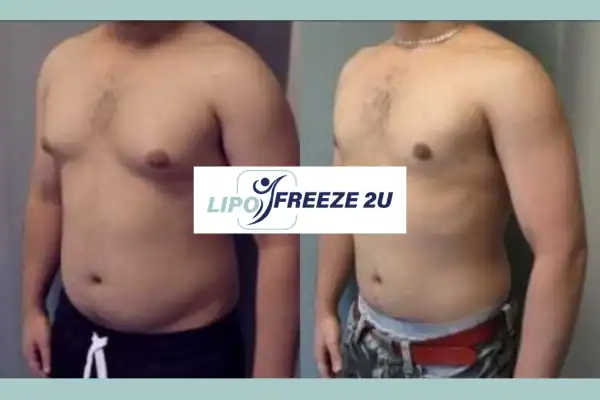 How Long Does It Take to See Results Southall?