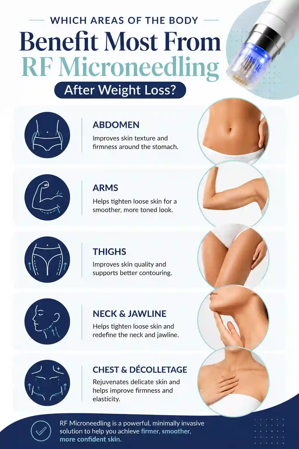 Which Areas of the Body Benefit Most From RF Microneedling After Weight Loss Southall